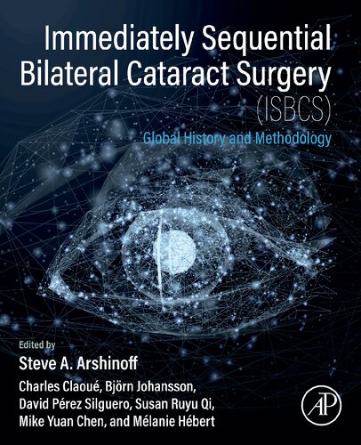 Immediately Sequential Bilateral Cataract Surgery Isbcs Global History And Methodology Steve A Arshinoff