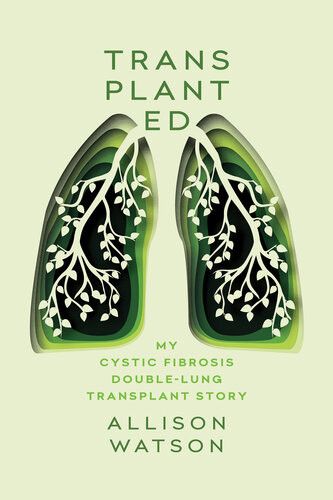 Transplanted Allison Watson