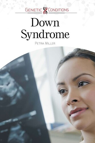 Down Syndrome Petra Miller