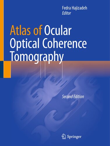 Atlas Of Ocular Optical Coherence Tomography 2nd Edition Fedra Hajizadeh
