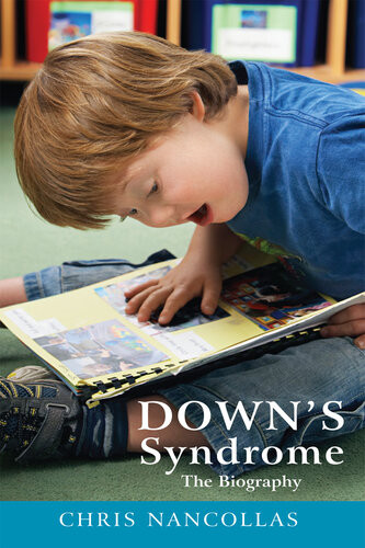Downs Syndrome The Biography 1st Edition Chris Nancollas