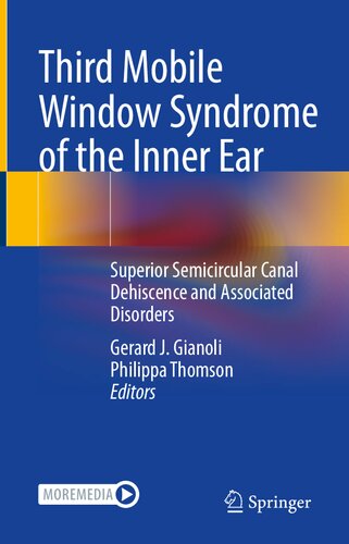 Third Mobile Window Syndrome Of The Inner Ear Superior Semicircular Canal Dehiscence And Associated Disorders Gerard J Gianoli