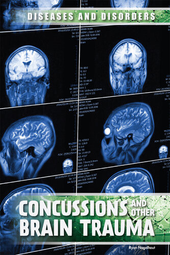 Concussions And Other Brain Trauma Ryan Nagelhout