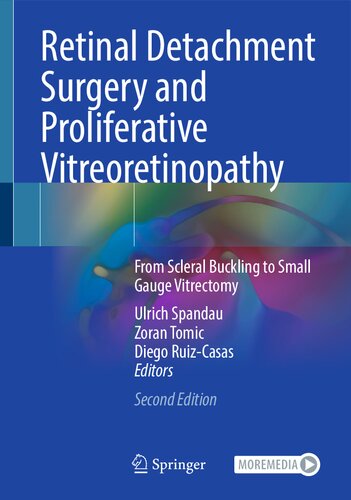 Retinal Detachment Surgery And Proliferative Vitreoretinopathy From Scleral Buckling To Small Gauge Vitrectomy 2nd 2nd Edition Ulrich Spandau