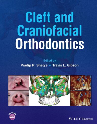 Cleft And Craniofacial Orthodontics 1st Edition Pradip R Shetye