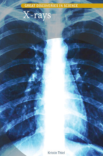 Xrays Kristin Thiel