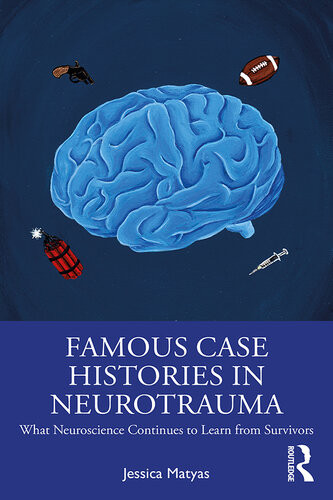 Famous Case Histories In Neurotrauma What Neuroscience Continues To Learn From Survivors Jessica Matyas