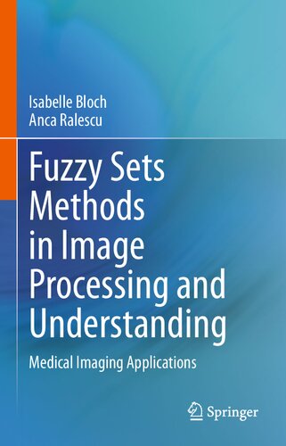 Fuzzy Sets Methods In Image Processing And Understanding Medical Imaging Applications Isabelle Bloch