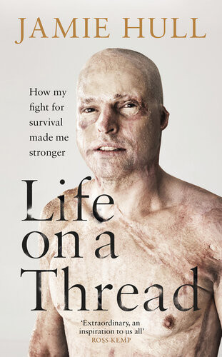 Life On A Thread My Story Jamie Hull