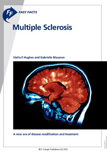 Fast Facts Multiple Sclerosis Fifth Edition Hughes Stella E And Macaron