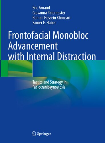 Frontofacial Monobloc Advancement With Internal Distraction Tactics And Strategy In Faciocraniosynostosis Eric Arnaud