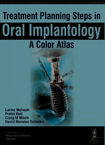 Treatment Planning Steps In Oral Implantology Lanka Mahesh Praful Bali