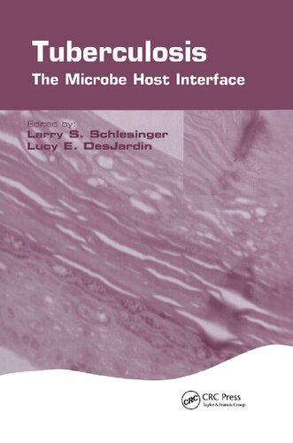 Tuberculosis The Microbe Host Interface Larry S Schlesinger
