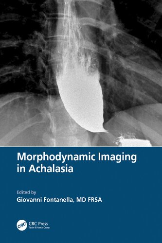 Morphodynamic Imaging In Achalasia Giovanni Fontanella