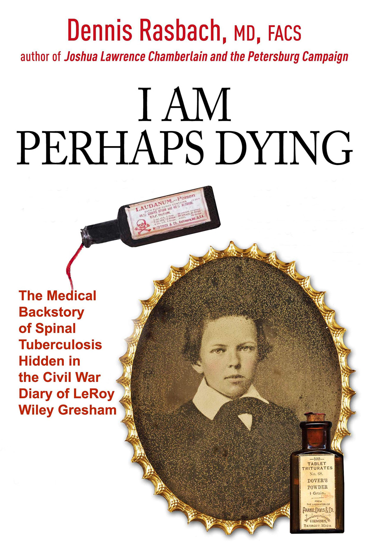 I Am Perhaps Dying The Medical Backstory Of Spinal Tuberculosis Hidden In The Civil War Diary Of Leroy Wiley Gresham Dennis A Rasbach Md Facs