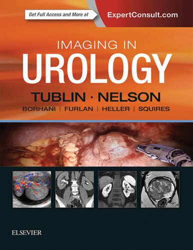 Imaging In Urology 1st Edition Mitchell Tublin Md Joel B Nelson Md