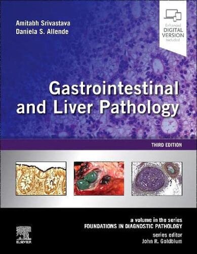 Gastrointestinal And Liver Pathology A Volume In The Series Foundations In Diagnostic Pathology 3rd Edition Amitabh Srivastava