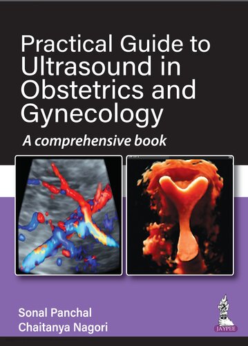 Practical Guide To Ultrasound In Obstetrics And Gynecology A Comprehensive Book Sonal Panchal