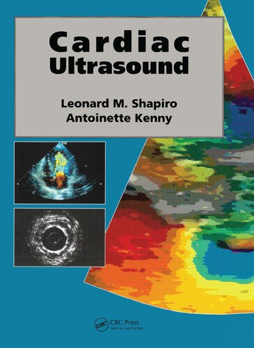 Cardiac Ultrasound 1st Edition Antoinette Kenny Kenny Antoinette