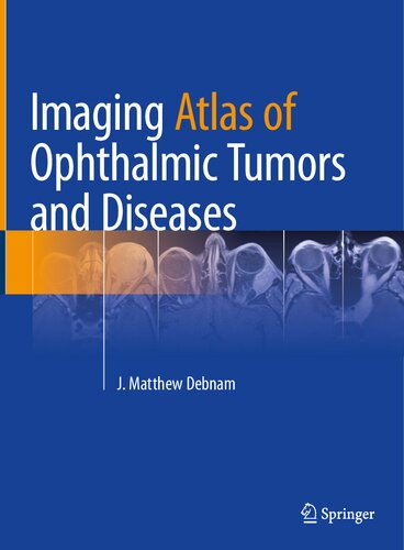 Imaging Atlas Of Ophthalmic Tumors And Diseases J Matthew Debnam