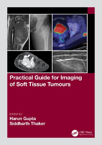 Practical Guide For Imaging Of Soft Tissue Tumours Harun Gupta