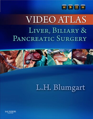 Video Atlas Liver Biliary Pancreatic Surgery 1st Edition Leslie H Blumgart