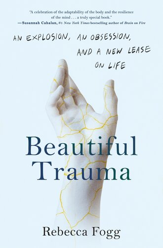 Beautiful Trauma An Explosion An Obsession And A New Lease On Life Rebecca Fogg