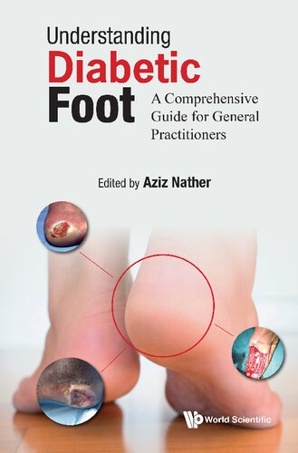 Understanding Diabetic Foot A Comprehensive Guide For General Practitioners Aziz Nather