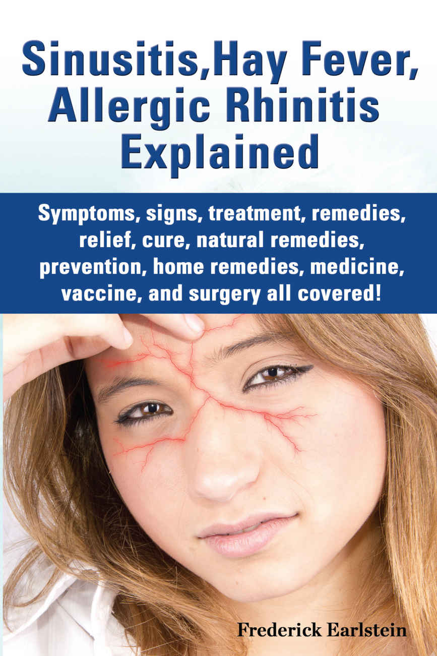 Sinusitis Hay Fever Allergic Rhinitis Explained Frederick Earlstein