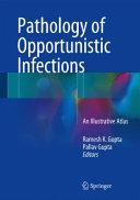 Pathology Of Opportunistic Infectionsan Illustrative Atlas Nov 26 20169811016682springer Ramesh K Gupta