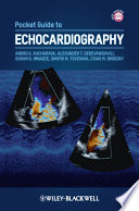 Pocket Guide To Echocardiography Andro G Kacharava Alexander T Gedevanishvili