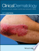 Clinical Dermatology 5th Edition 5th Richard B Weller Hamish J A Hunter