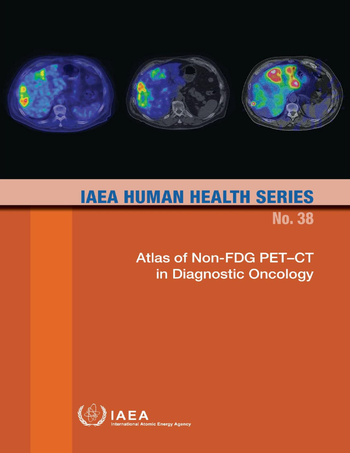 Atlas Of Nonfdg Petct In Diagnostic Oncology Iaea