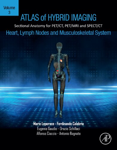Atlas Of Hybrid Imaging Sectional Anatomy For Petct Petmri And Spectct Vol 3 Heart Lymph Node And Musculoskeletal System Sectional Anatomy For Petct Petmri And Spectct Mario Leporace