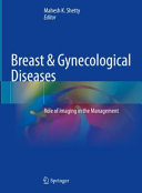 Breast Gynecological Diseases Role Of Imaging In The Management 1st Mahesh K Shetty Editor