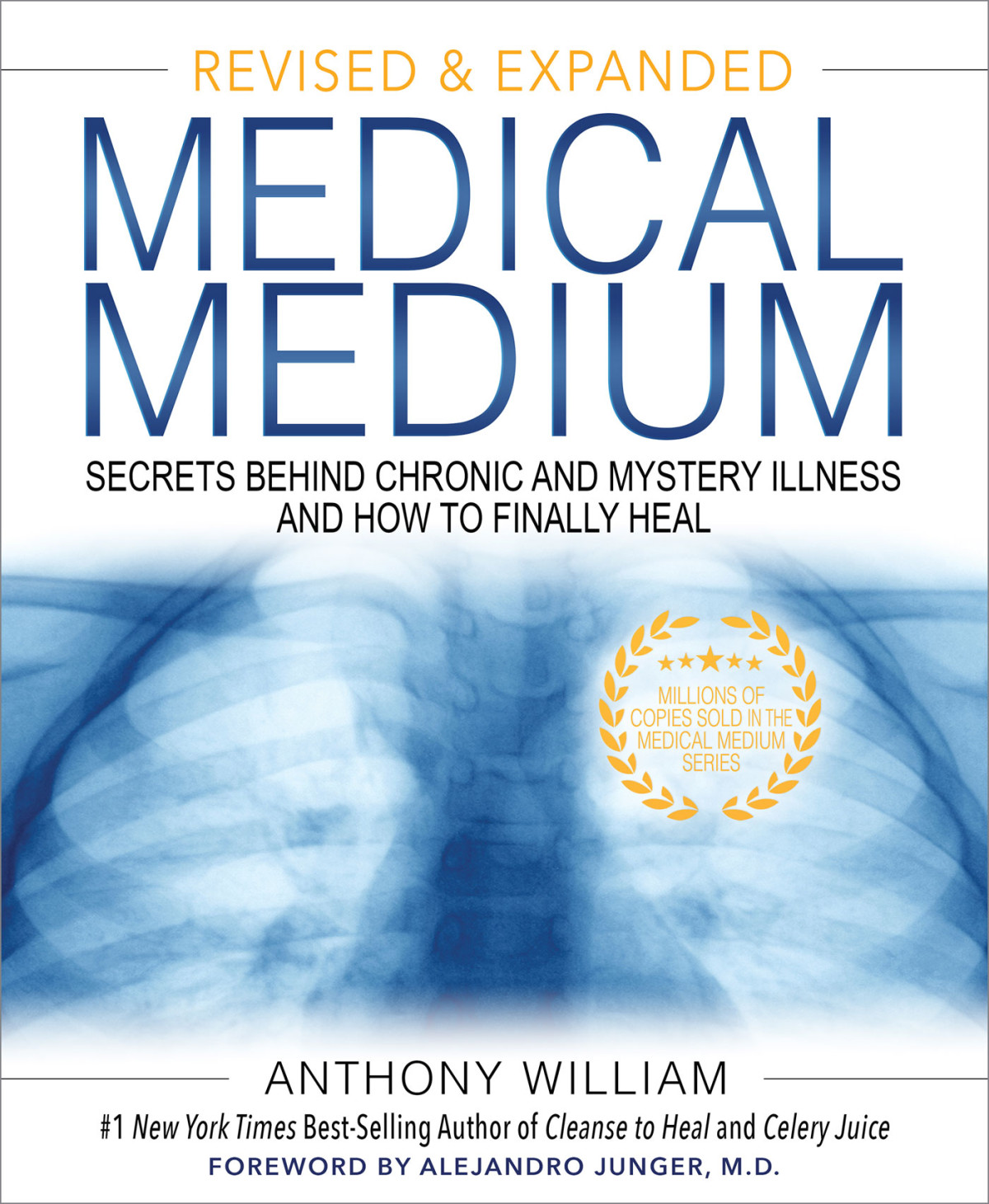 Medical Medium Secrets Behind Chronic And Mystery Illness And How To Finally Heal Revised And Expanded Edition Anthony William