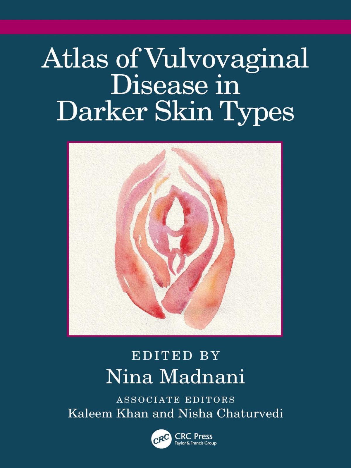 Atlas Of Vulvovaginal Disease In Darker Skin Types 1st Nina Madnani Editor