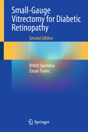 Smallgauge Vitrectomy For Diabetic Retinopathy 2nd Edition 2nd Ulrich Spandau