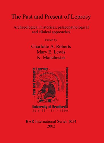 The Past And Present Of Leprosy Archaeological Historical Palaeopathological And Clinical Approaches Charlotte A Roberts
