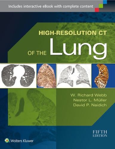 High Resolution Ct Of The Lung 5th Edition W Richard Webb Nestor L Muller
