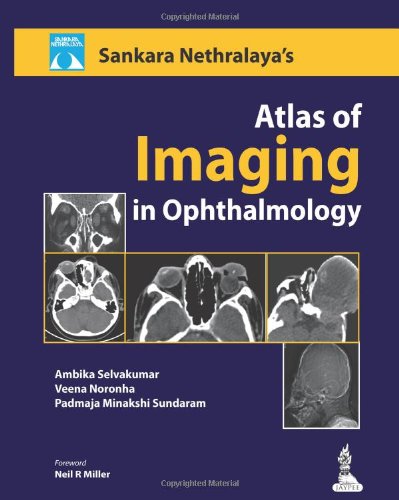 Sankara Nethralayas Atlas Of Imaging In Ophthalmology Ambika Selvakumar