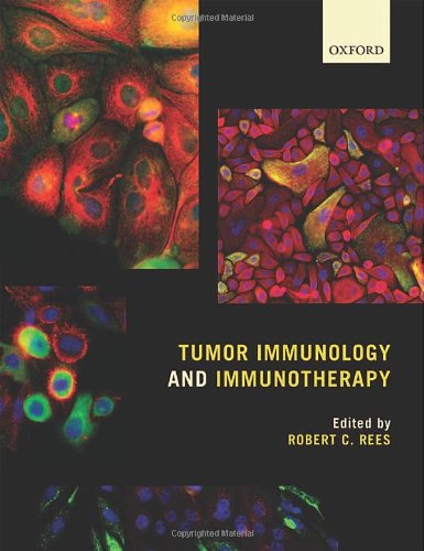 Tumor Immunology And Immunotherapy 1st Edition Robert C Rees