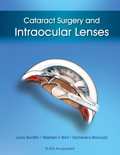 Cataract Surgery And Intraocular Lenses Lucio Buratto Stephen Brint