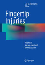 Fingertip Injuries Diagnosis Management And Reconstruction 1st Edition Leo M Rozmaryn Eds
