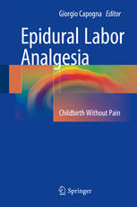 Epidural Labor Analgesia Childbirth Without Pain 1st Edition Giorgio Capogna Eds