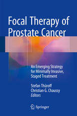 Focal Therapy Of Prostate Cancer An Emerging Strategy For Minimally Invasive Staged Treatment 1st Edition Stefan Throff