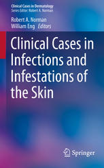 Clinical Cases In Infections And Infestations Of The Skin 1st Edition Robert A Norman