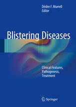 Blistering Diseases Clinical Features Pathogenesis Treatment 1st Edition Dde F Murrell Eds