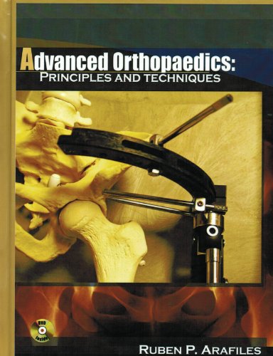 Advanced Orthopaedics Principles And Techniques 1st Md Ruben P Arafiles