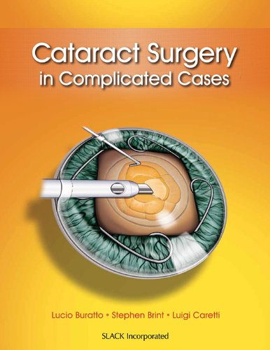 Cataract Surgery In Complicated Cases 1st Edition Lucio Buratto Md